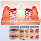 Eye Massage Device Eye Care Lifting Tightening Dark Circles Eye Bag Removal